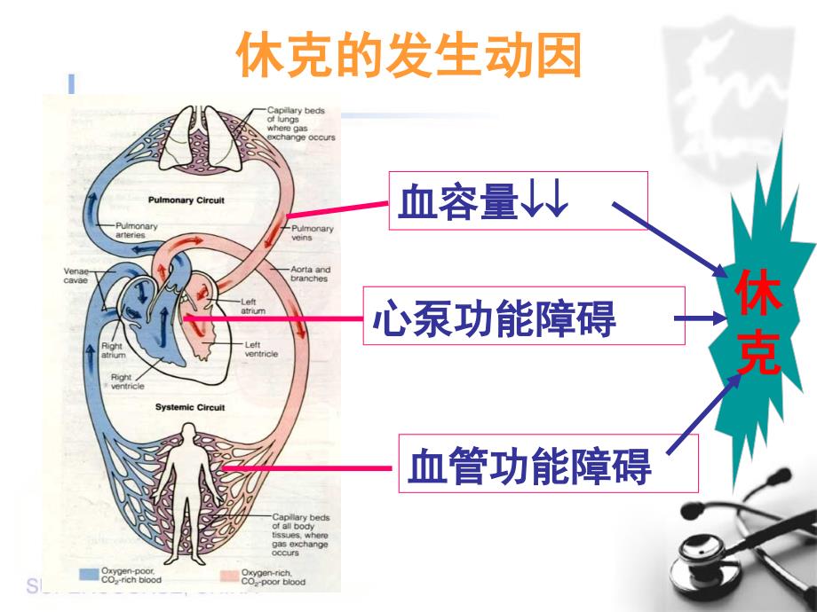 出血性休克.ppt_第5页