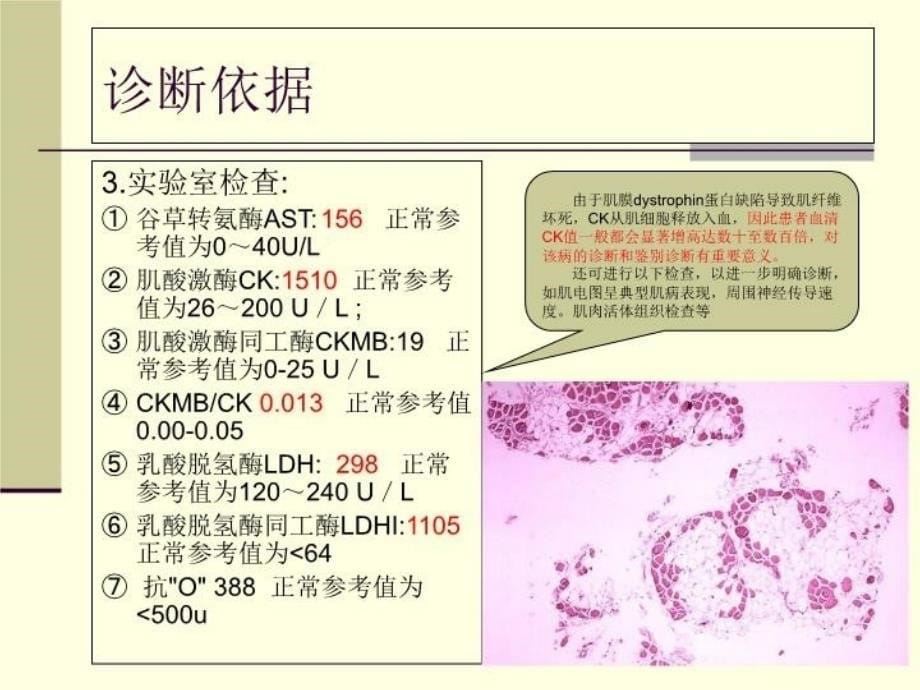 最新北京华科医院痿证科假肥大性肌营养不良幻灯片_第5页