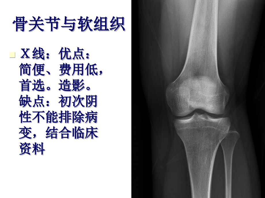 医学影像学：16第九章 骨关节与软组织_第2页