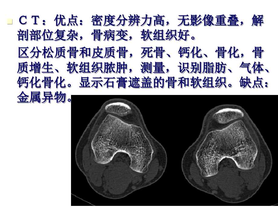 医学影像学：16第九章 骨关节与软组织_第3页