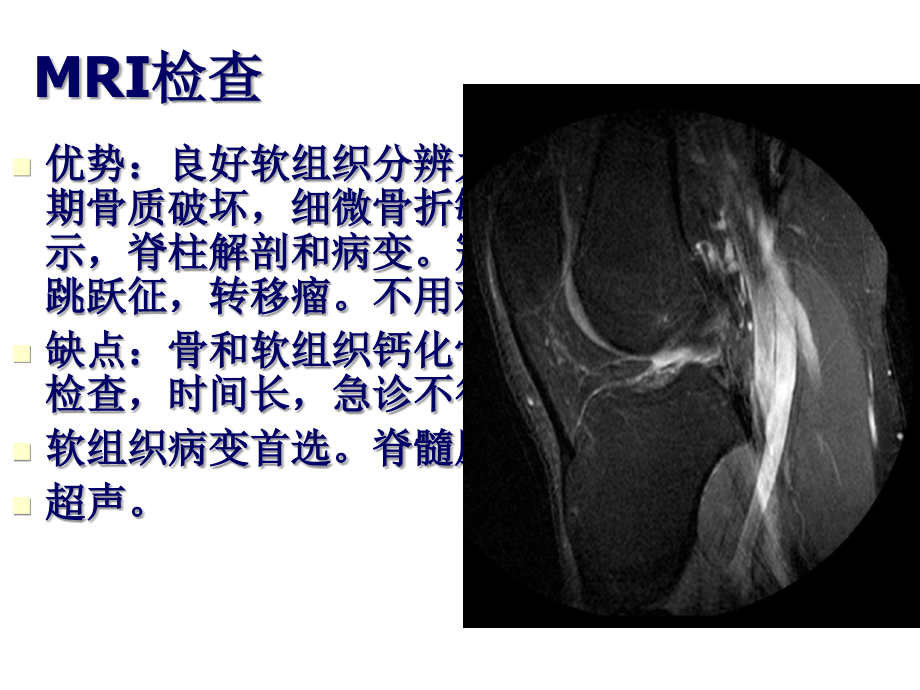 医学影像学：16第九章 骨关节与软组织_第4页