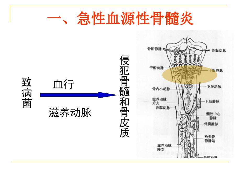 骨与关节化脓性感染1_第3页