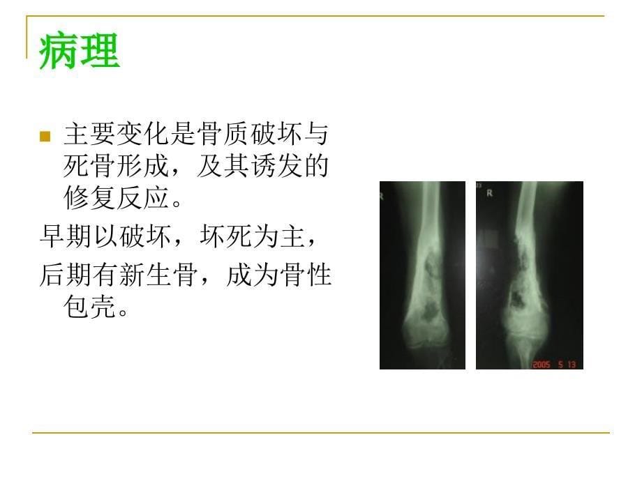 骨与关节化脓性感染1_第5页