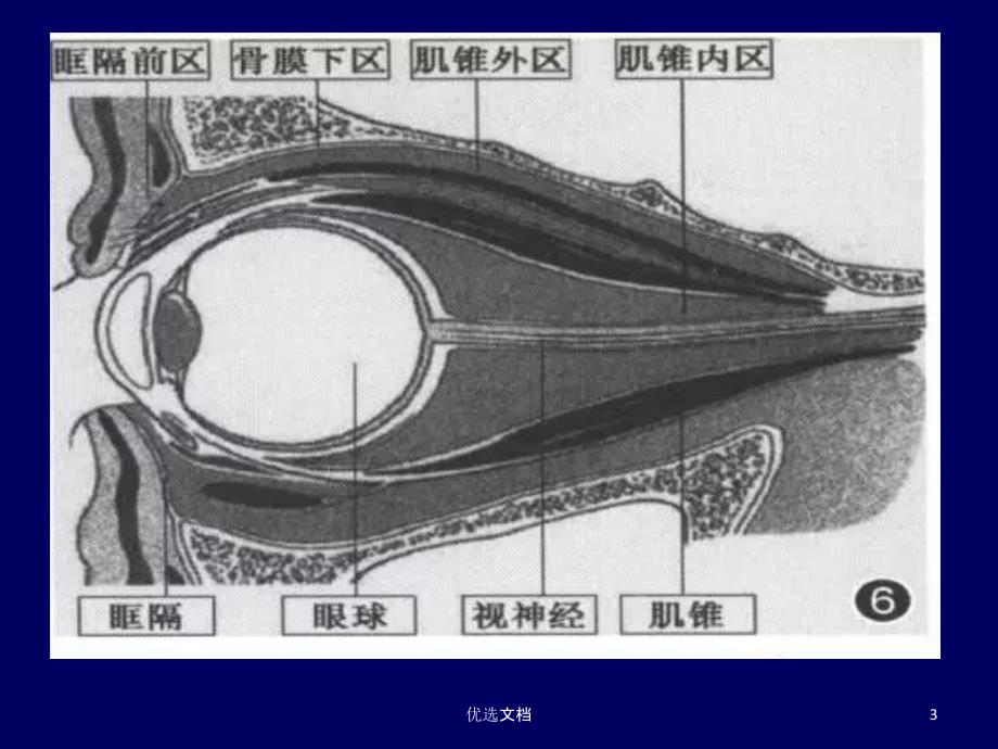 常见眼眶内肿瘤的影像诊断分析全版.ppt课件_第3页