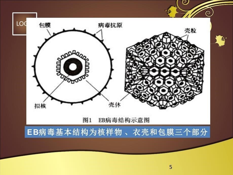 慢性活动性EB病毒感染ppt课件_第5页