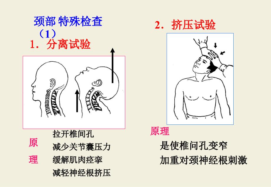 实训骨伤科特殊检查法与神经、x线()课件_第2页