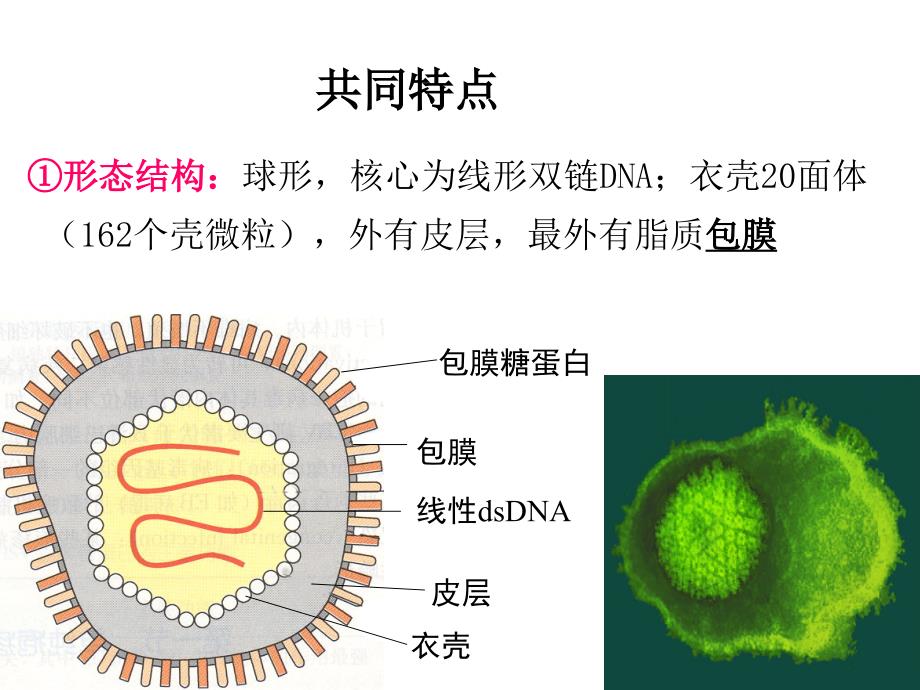 推荐2单纯疱疹病毒_第4页