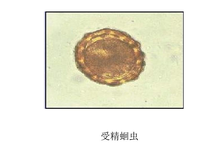 7版教材寄生虫图片_第1页