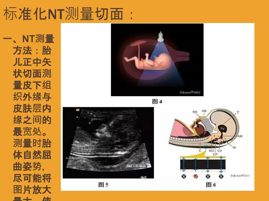 NT检查规范PPT课件_第4页