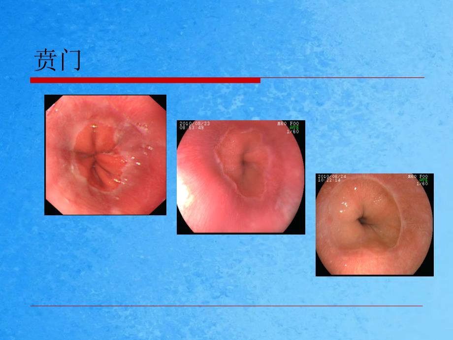 胃镜检查速读ppt课件_第2页