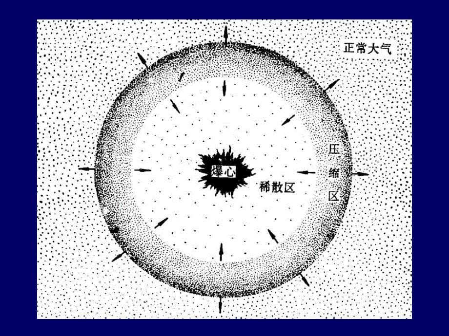 病理学战伤病理学第二章冲击伤解读_第5页