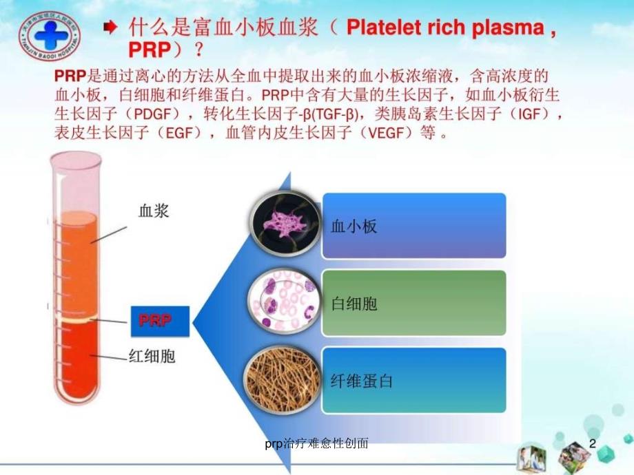 prp治疗难愈性创面课件_第2页