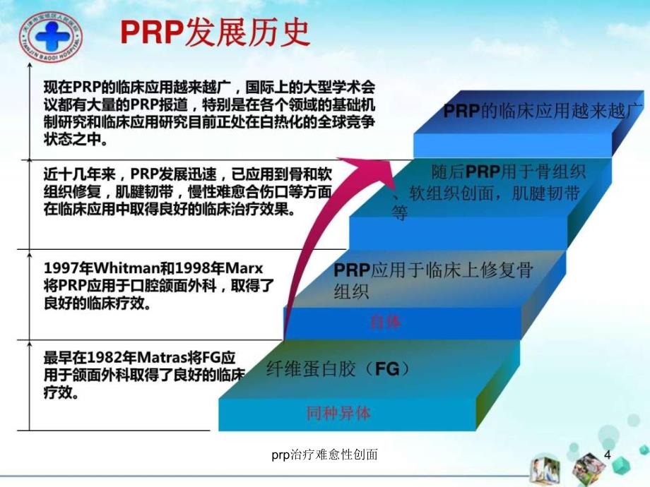 prp治疗难愈性创面课件_第4页