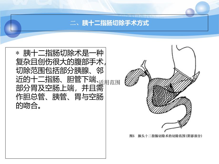 胆囊切除-胰十二指肠切除术后护理_第3页