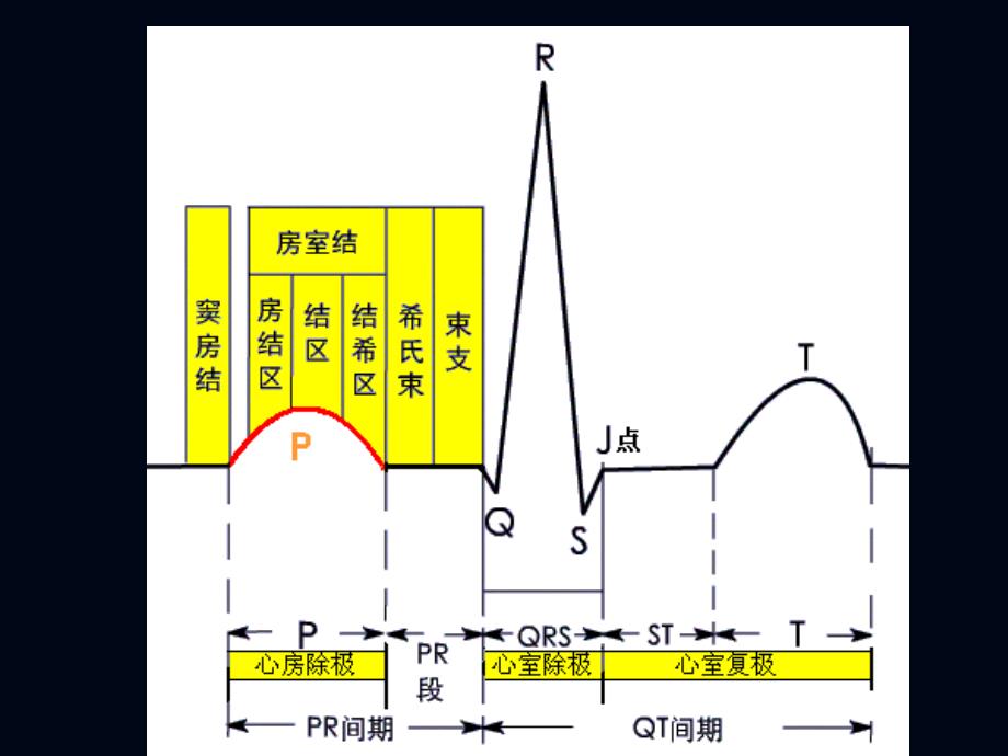 心电图2肥大缺血_第2页