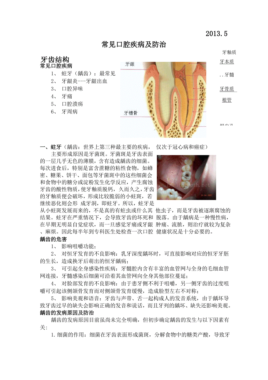 常见口腔疾病及防治_第2页