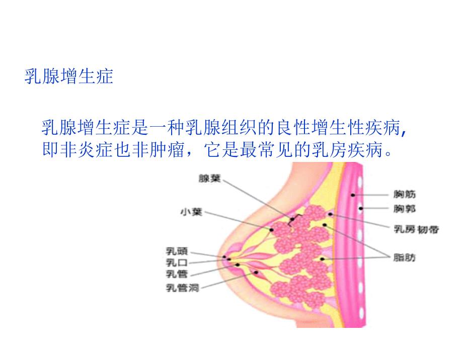 乳腺增生症ppt课件_第2页