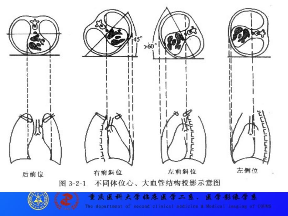 心脏与大血管-X线读片训练_第4页