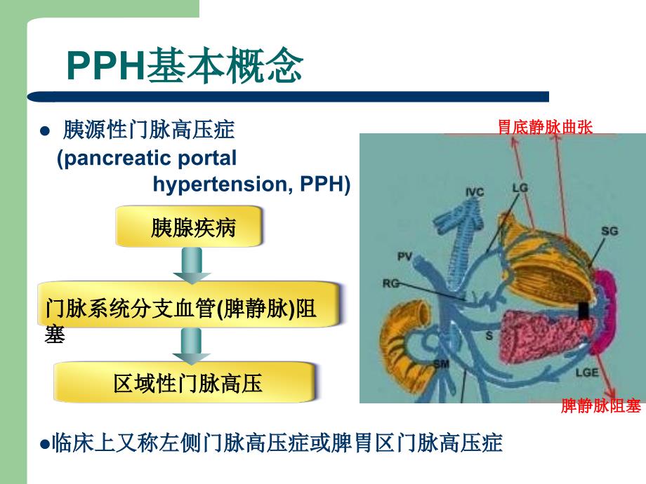 《胰源性门脉高压症》PPT课件_第2页