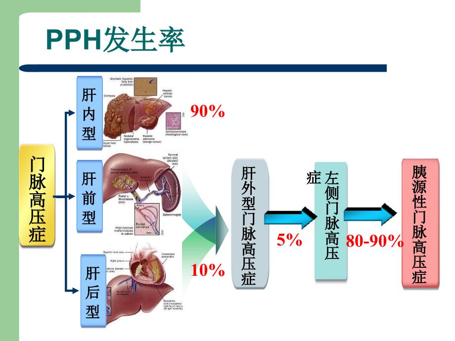 《胰源性门脉高压症》PPT课件_第3页