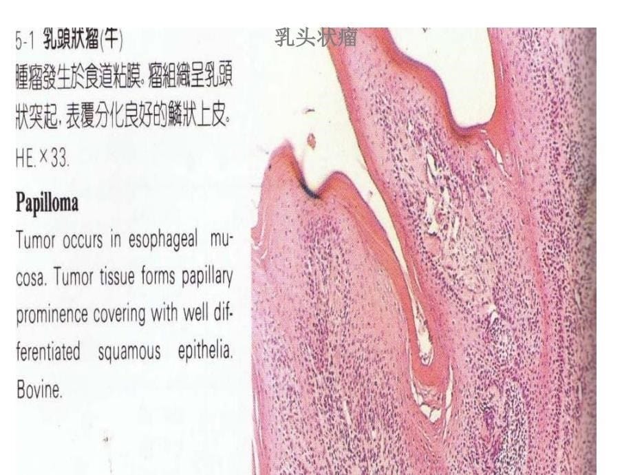 《肿瘤病理变化》PPT课件_第5页