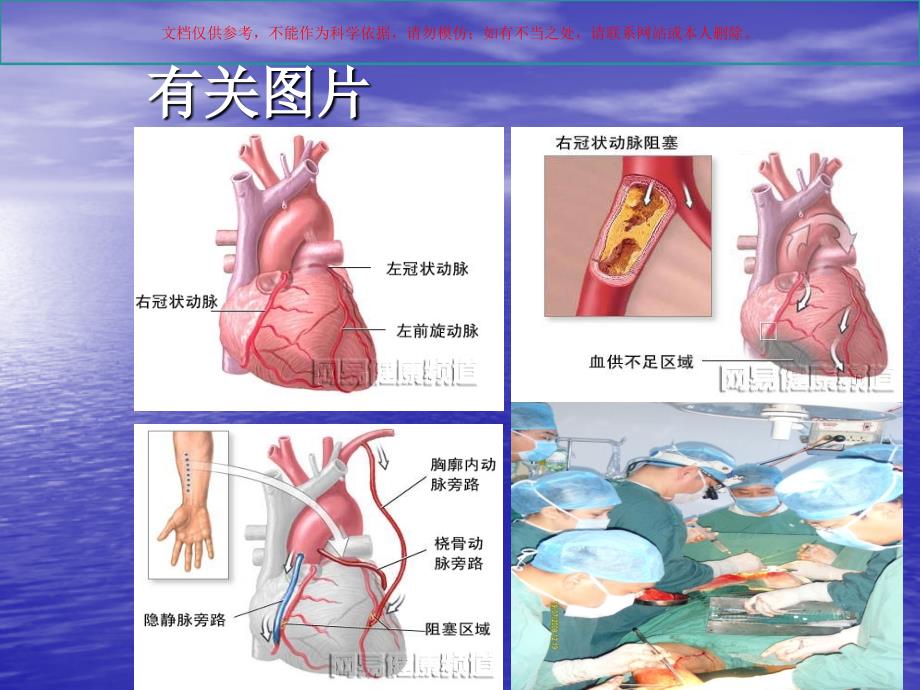 冠心病合并慢阻肺护理查房课件_第4页