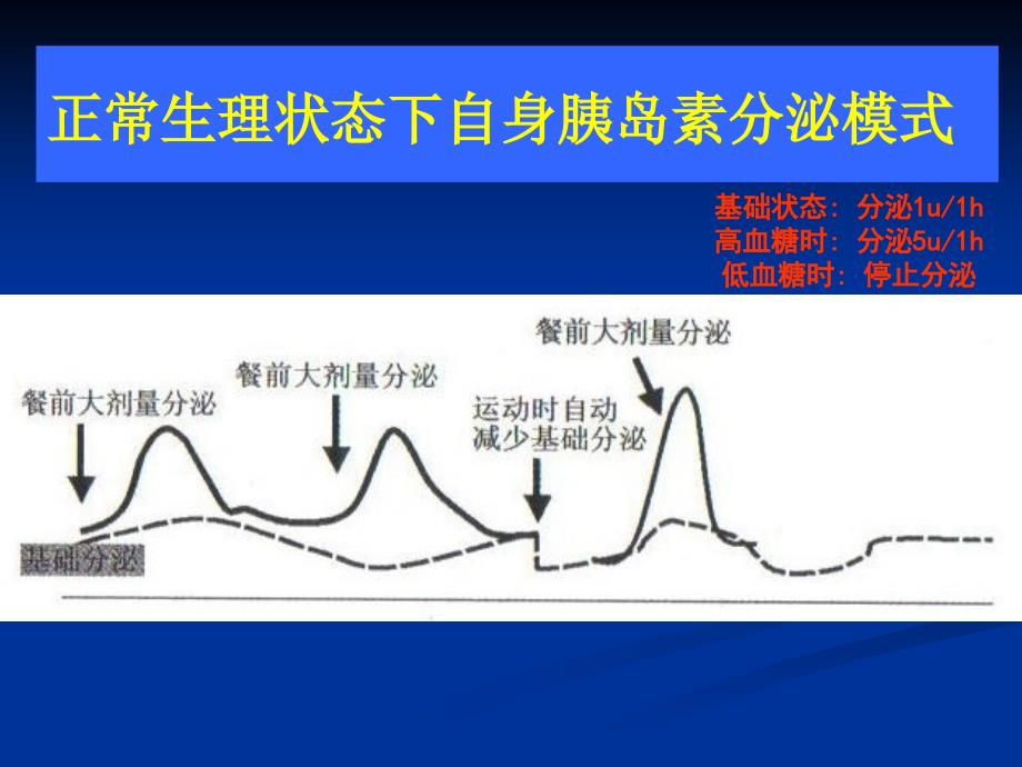 胰岛素泵临床使用.ppt_第3页