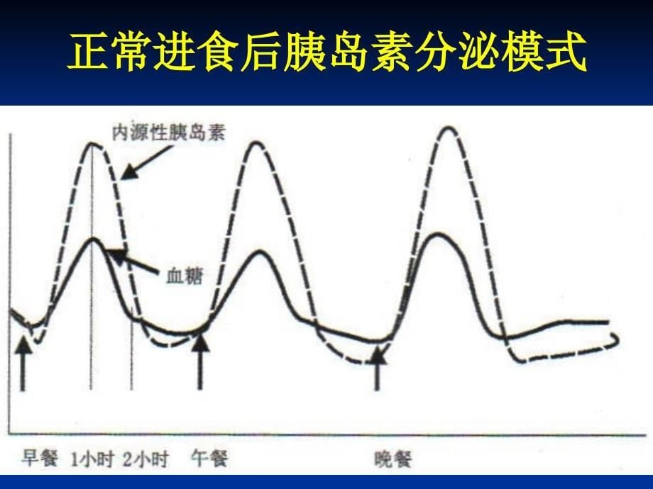 胰岛素泵临床使用.ppt_第5页