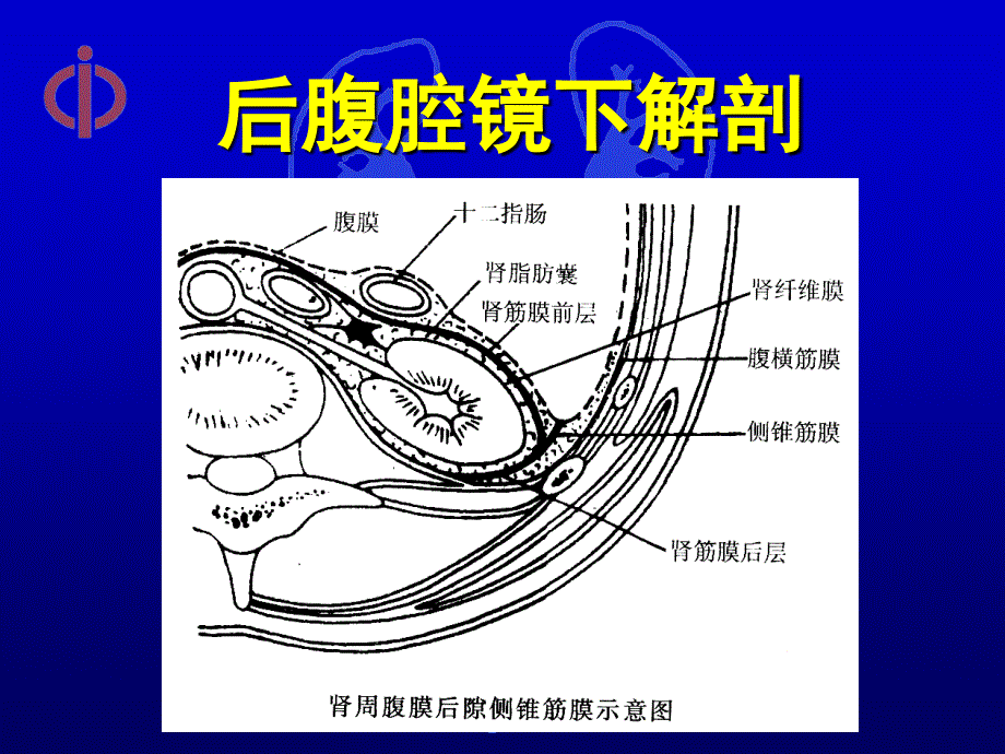 最新后腹腔镜肾上腺手术探讨PPT文档_第3页