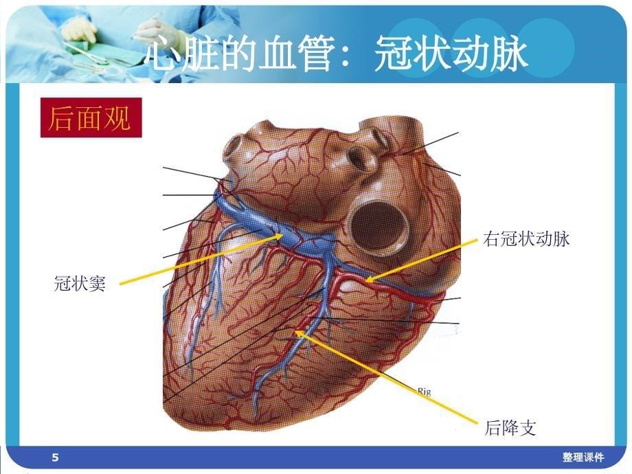 冠状动脉造影经皮冠状动脉介入术围手术期护理课件_第5页