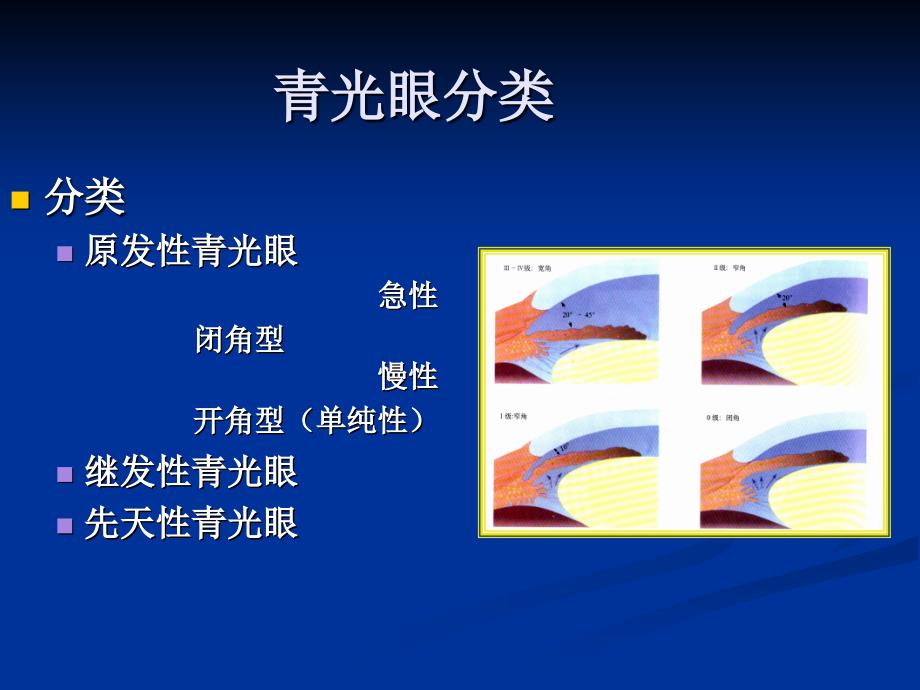 青光眼药物治疗进展_第4页