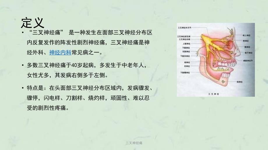 三叉神经痛课件_第2页