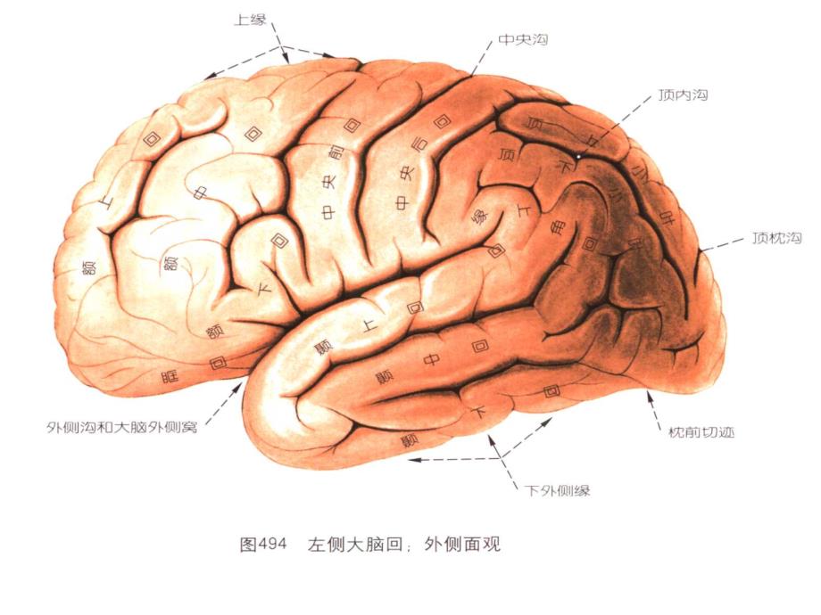 脑出血磁共振课件_第2页