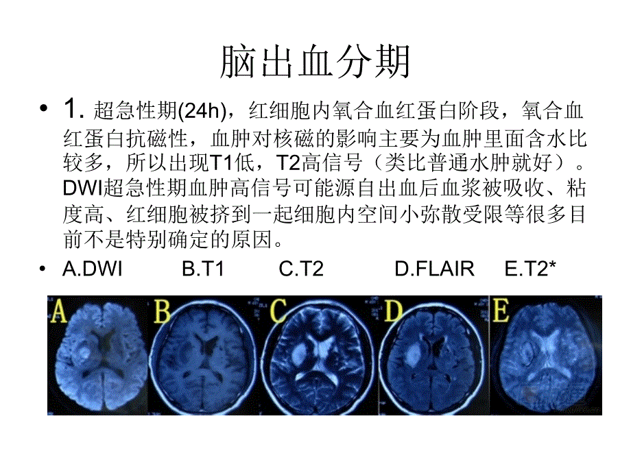 脑出血磁共振课件_第4页