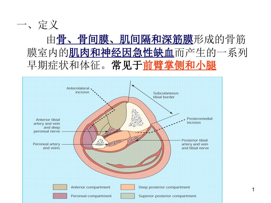 骨筋膜室综合征课件_第1页