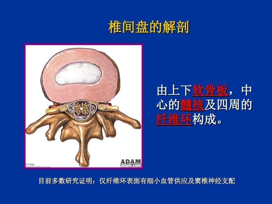 综合保守治疗腰椎间盘突出症_第5页