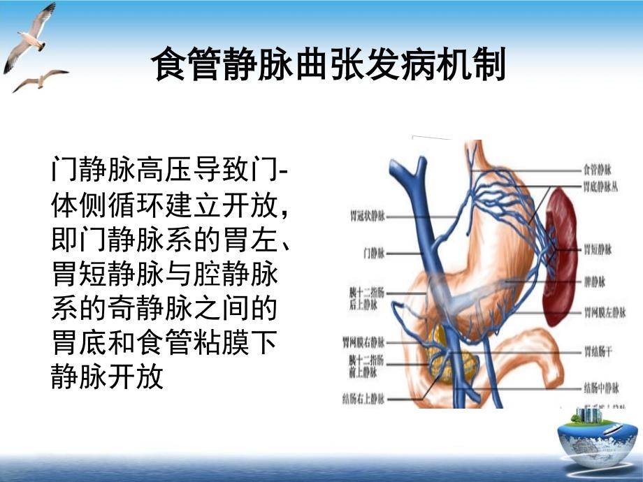 食管胃底静脉曲张治疗PPT幻灯片课件_第2页