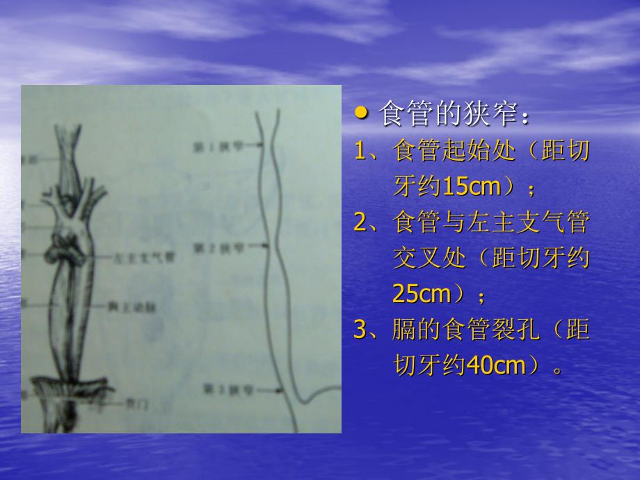 最新X线诊断学消化系统课件PPT文档_第2页