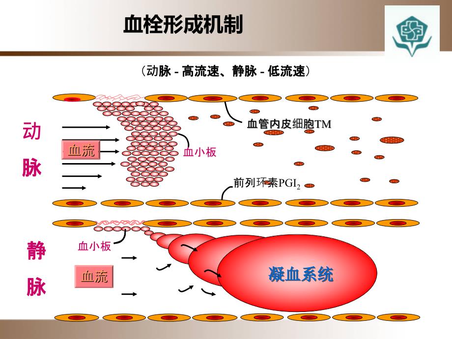 ICU抗凝药物合理应用演示教学_第2页