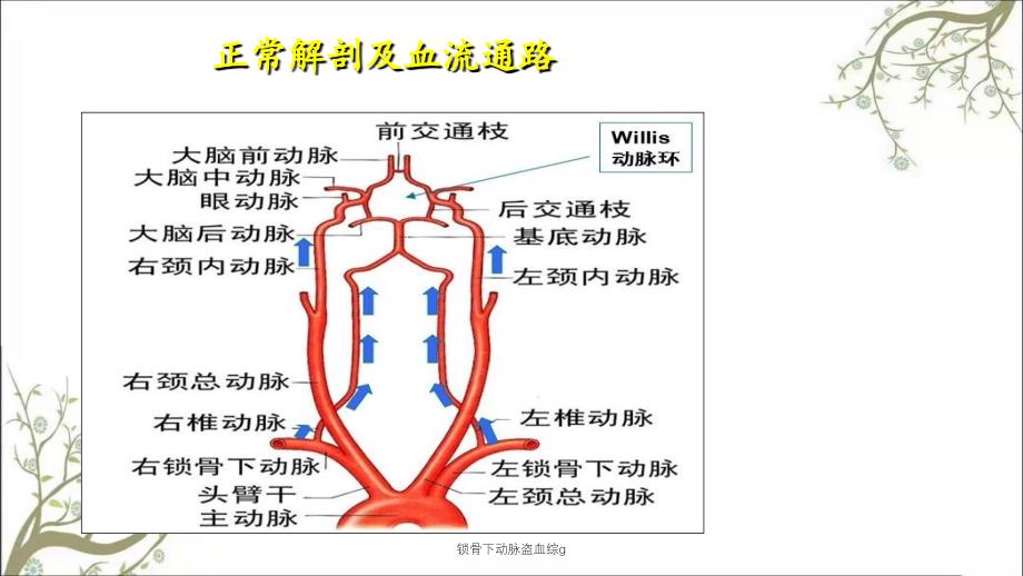 锁骨下动脉盗血综g_第4页