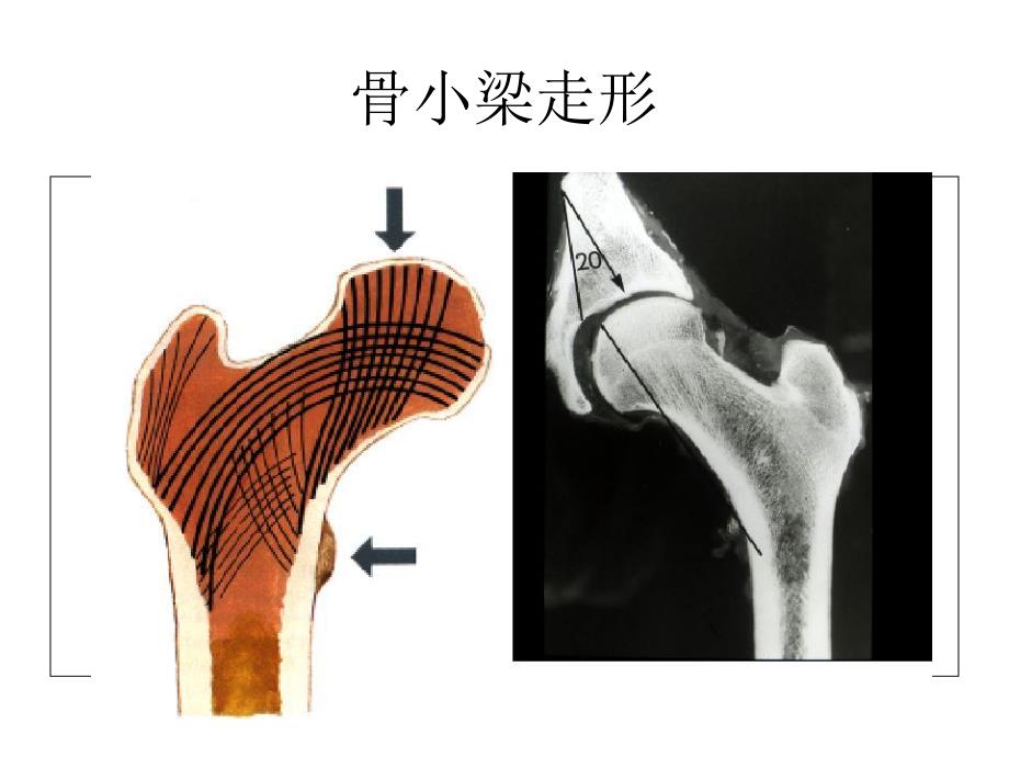 股骨颈骨折从解剖到手术全面阐述_第2页