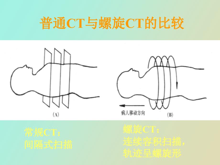 螺旋ct后处理技术的临床应用_第4页