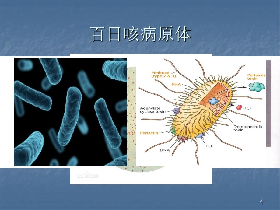 《百日咳综合征》PPT课件.ppt_第4页