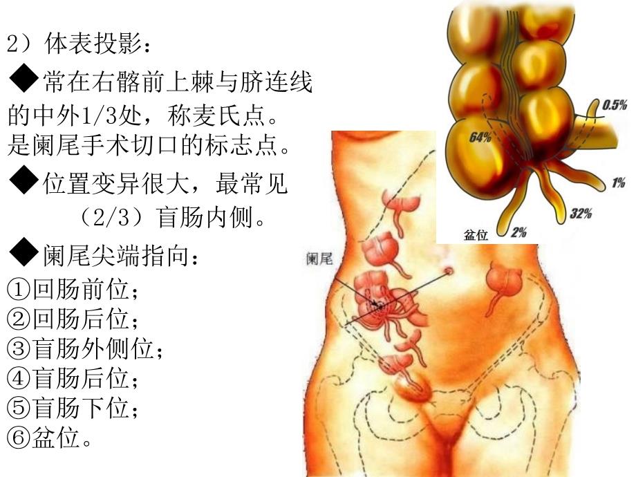 急性阑尾炎教学查房_第4页