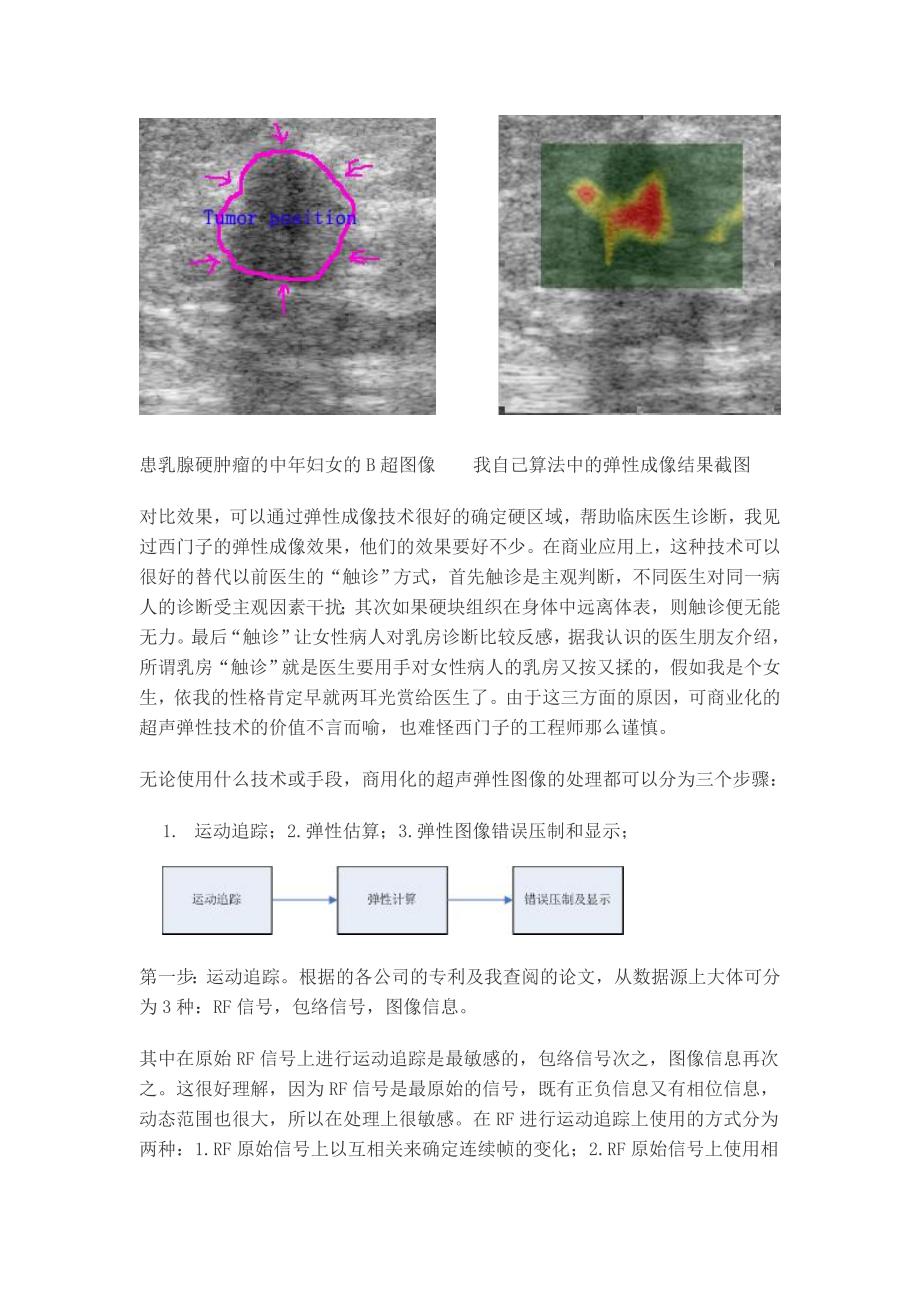 超声诊断中的弹性成像技术介绍.doc_第2页