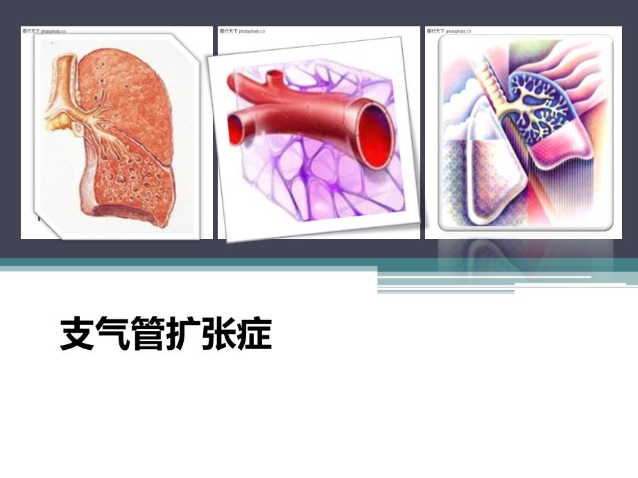 内科护理学支气管扩张_第1页