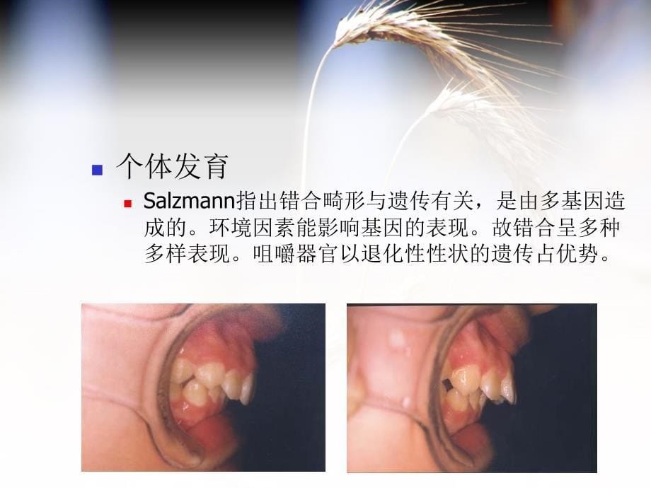 错合畸形的病因二_第5页