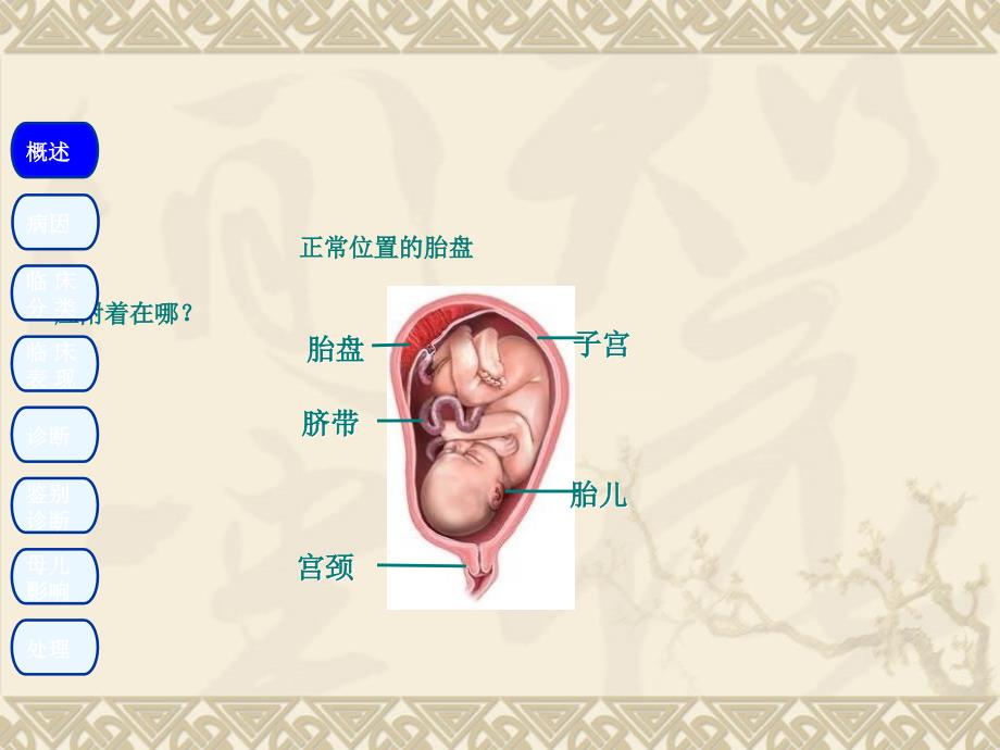 前置胎盘PPT课件_第3页