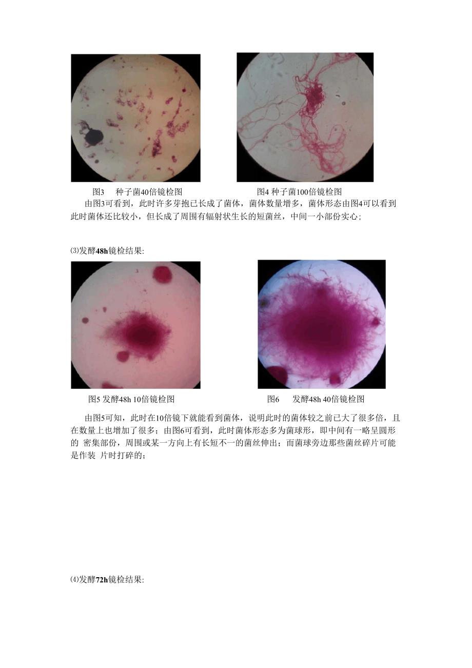 纳他霉素的发酵生产、分离纯化及检测_第4页