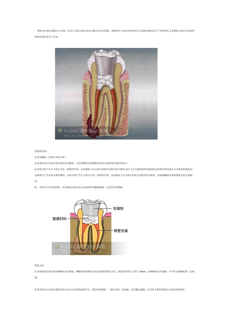 根管治疗为什么要永久充填.doc_第1页